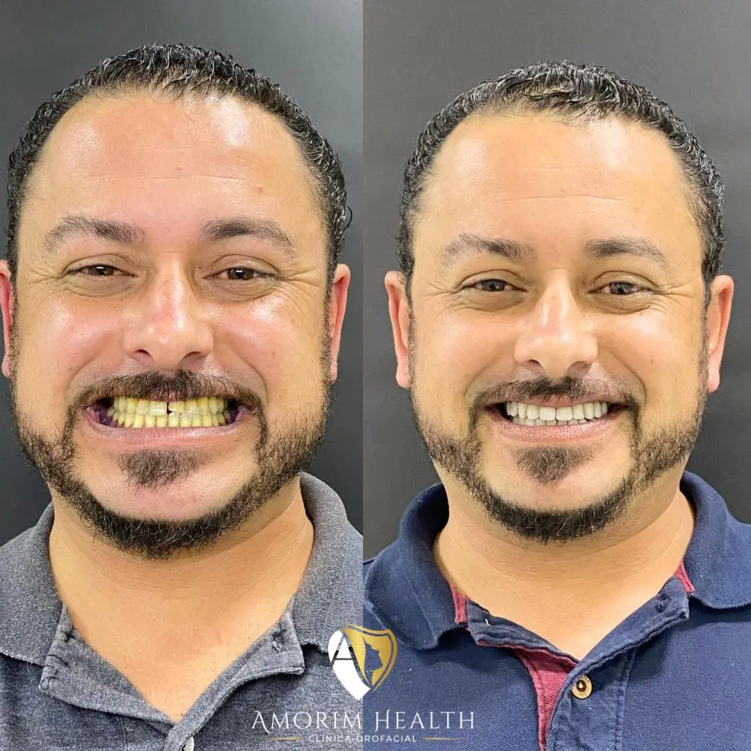 Dentística e Estética Dental