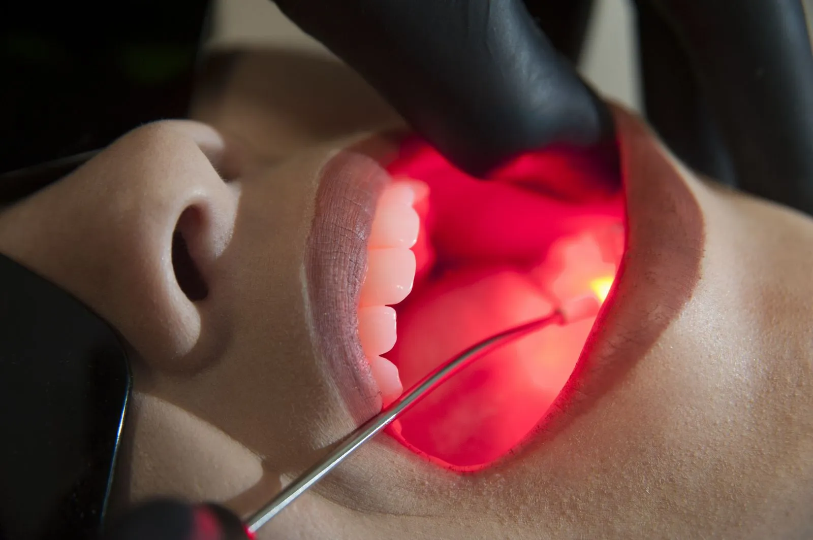 Cicatrização com Laser